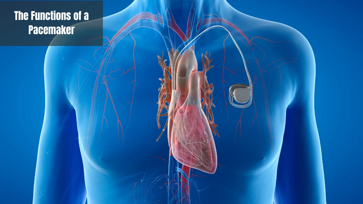 Pacemaker